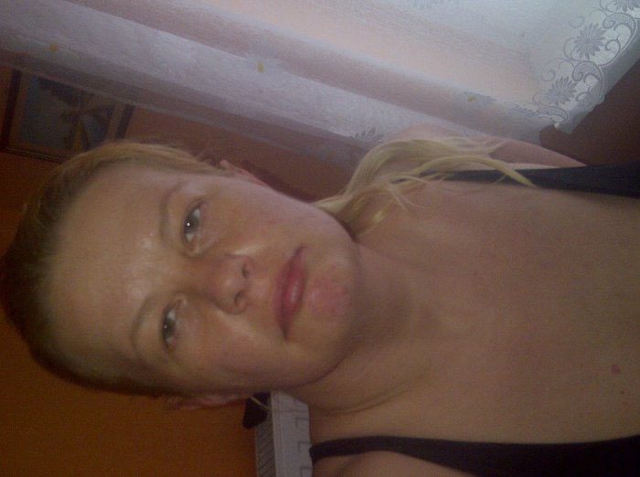 Akve, 49